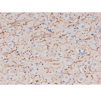 P2RY12 / P2Y12 Antibody - 1:200 staining rat brain tissue by IHC-P. The tissue was formaldehyde fixed and a heat mediated antigen retrieval step in citrate buffer was performed. The tissue was then blocked and incubated with the antibody for 1.5 hours at 22°C. An HRP conjugated goat anti-rabbit antibody was used as the secondary.