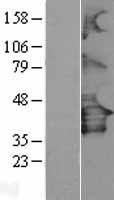 P2RY12 / P2Y12 Protein - Western validation with an anti-DDK antibody * L: Control HEK293 lysate R: Over-expression lysate