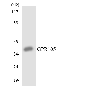 P2RY14 / GPR105 Antibody - Western blot analysis of the lysates from K562 cells using GPR105 antibody.