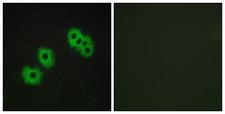 P2RY14 / GPR105 Antibody - Immunofluorescence analysis of MCF7 cells, using GPR105 Antibody. The picture on the right is blocked with the synthesized peptide.