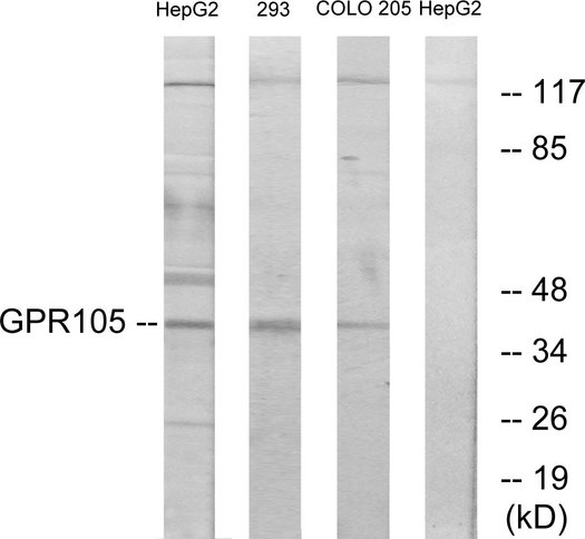P2RY14 / GPR105 Antibody - Western blot analysis of lysates from 293, COLO205, and HepG2 cells, using GPR105 Antibody. The lane on the right is blocked with the synthesized peptide.