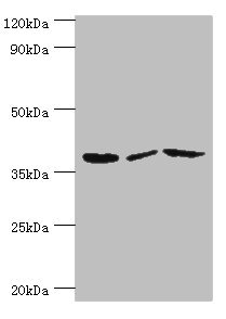 P2RY14 / GPR105 Antibody - Western blot All lanes: P2RY14 antibody at 12µg/ml Lane 1: Mouse heart tissue Lane 2: Mouse stomach tissue Lane 3: Mouse small intestine tissue Secondary Goat polyclonal to rabbit IgG at 1/10000 dilution Predicted band size: 39 kDa Observed band size: 39 kDa