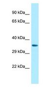 P2RY14 / GPR105 Antibody - P2RY14 / GPR105 antibody Western Blot of Fetal Heart.  This image was taken for the unconjugated form of this product. Other forms have not been tested.