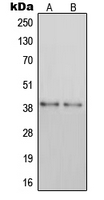 P2RY14 / GPR105 Antibody - Western blot analysis of GPR105 expression in MDAMB435 (A); HEK293 (B) whole cell lysates.