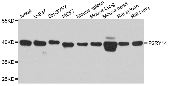 P2RY14 / GPR105 Antibody - Western blot analysis of extract of various cells.