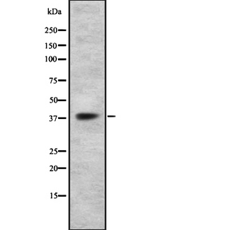 P2RY14 / GPR105 Antibody - Western blot analysis GPR105 using HT29 whole cells lysates