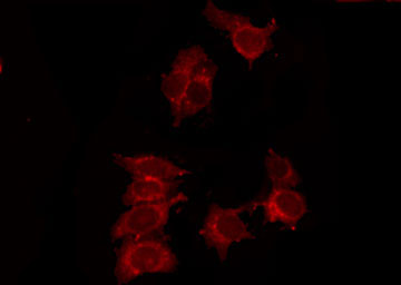 P2RY14 / GPR105 Antibody - Staining 293 cells by IF/ICC. The samples were fixed with PFA and permeabilized in 0.1% Triton X-100, then blocked in 10% serum for 45 min at 25°C. The primary antibody was diluted at 1:200 and incubated with the sample for 1 hour at 37°C. An Alexa Fluor 594 conjugated goat anti-rabbit IgG (H+L) Ab, diluted at 1/600, was used as the secondary antibody.