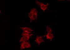 P2RY14 / GPR105 Antibody - Staining 293 cells by IF/ICC. The samples were fixed with PFA and permeabilized in 0.1% Triton X-100, then blocked in 10% serum for 45 min at 25°C. The primary antibody was diluted at 1:200 and incubated with the sample for 1 hour at 37°C. An Alexa Fluor 594 conjugated goat anti-rabbit IgG (H+L) Ab, diluted at 1/600, was used as the secondary antibody.