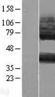 P2RY14 / GPR105 Protein - Western validation with an anti-DDK antibody * L: Control HEK293 lysate R: Over-expression lysate