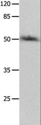 P2RY2 / P2Y2 Antibody - Western blot analysis of HT-29 cell, using P2RY2 Polyclonal Antibody at dilution of 1:500.