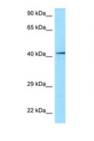 P2RY2 / P2Y2 Antibody - P2RY2 / P2Y2 antibody Western blot of MCF7 Cell lysate. Antibody concentration 1 ug/ml.  This image was taken for the unconjugated form of this product. Other forms have not been tested.