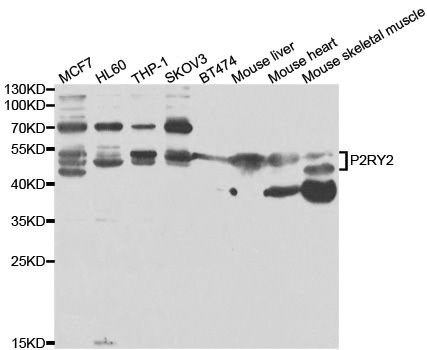 P2RY2 / P2Y2 Antibody - Western blot analysis of extracts of various cell lines, using P2RY2 antibody at 1:1000 dilution. The secondary antibody used was an HRP Goat Anti-Rabbit IgG (H+L) at 1:10000 dilution. Lysates were loaded 25ug per lane and 3% nonfat dry milk in TBST was used for blocking.