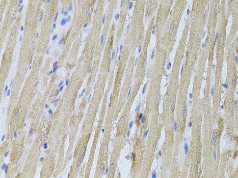 P2RY2 / P2Y2 Antibody - Immunohistochemistry of paraffin-embedded Rat heart using P2RY2 Polyclonal Antibody at dilution of 1:100 (40x lens).