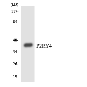 P2RY4 / P2Y4 Antibody - Western blot analysis of the lysates from COLO205 cells using P2RY4 antibody.