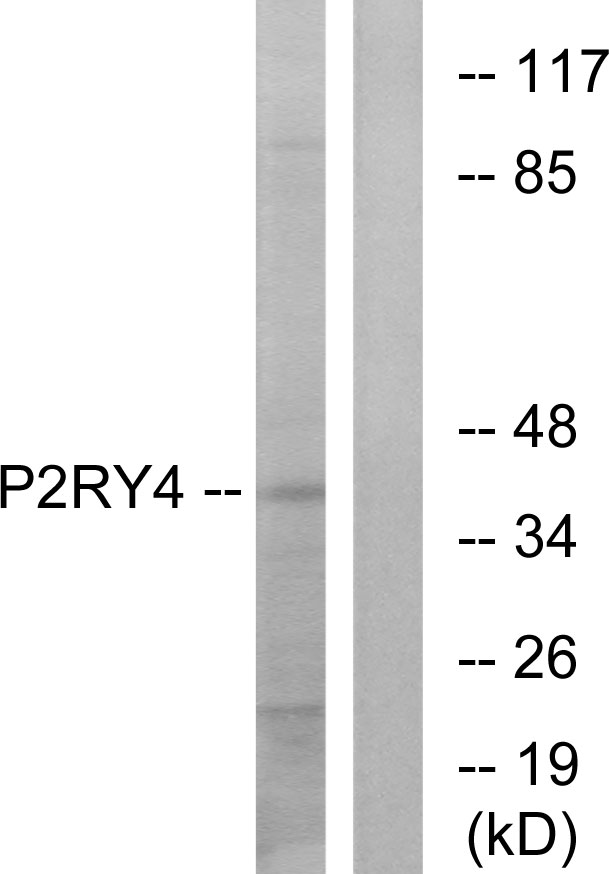 P2RY4 / P2Y4 Antibody - Western blot analysis of lysates from HeLa cells, using P2RY4 Antibody. The lane on the right is blocked with the synthesized peptide.