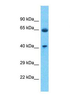 P2RY4 / P2Y4 Antibody - Western blot of Human Fetal Lung. P2RY4 antibody dilution 1.0 ug/ml.  This image was taken for the unconjugated form of this product. Other forms have not been tested.