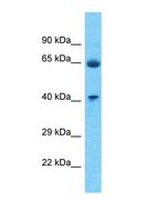 P2RY4 / P2Y4 Antibody - Western blot of Human Fetal Lung. P2RY4 antibody dilution 1.0 ug/ml.  This image was taken for the unconjugated form of this product. Other forms have not been tested.