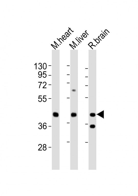 P2RY4 / P2Y4 Antibody - All lanes : Anti-P2ry4 Antibody at 1:2000 dilution Lane 1: mouse heart lysates Lane 2: mouse liver lysates Lane 3: rat brain lysates Lysates/proteins at 20 ug per lane. Secondary Goat Anti-Rabbit IgG, (H+L), Peroxidase conjugated at 1/10000 dilution Predicted band size : 41 kDa Blocking/Dilution buffer: 5% NFDM/TBST.