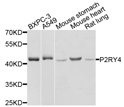 P2RY4 / P2Y4 Antibody - Western blot analysis of extracts of various cells.