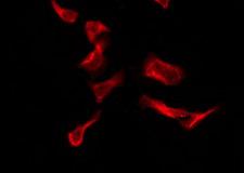 P2RY4 / P2Y4 Antibody - Staining HeLa cells by IF/ICC. The samples were fixed with PFA and permeabilized in 0.1% Triton X-100, then blocked in 10% serum for 45 min at 25°C. The primary antibody was diluted at 1:200 and incubated with the sample for 1 hour at 37°C. An Alexa Fluor 594 conjugated goat anti-rabbit IgG (H+L) Ab, diluted at 1/600, was used as the secondary antibody.
