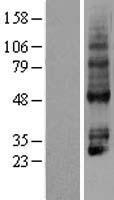 P2RY4 / P2Y4 Protein - Western validation with an anti-DDK antibody * L: Control HEK293 lysate R: Over-expression lysate