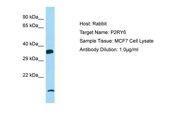 P2RY6 / P2Y6 Antibody -  This image was taken for the unconjugated form of this product. Other forms have not been tested.