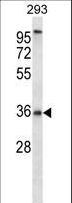 P2RY6 / P2Y6 Antibody - P2RY6 Antibody western blot of 293 cell line lysates (35 ug/lane). The P2RY6 antibody detected the P2RY6 protein (arrow).