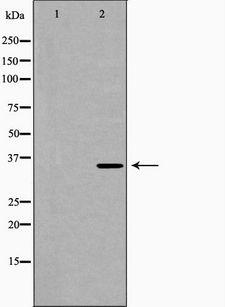 P2RY6 / P2Y6 Antibody - Western blot analysis of mouse brain lysate using P2RY6 antibody. The lane on the left is treated with the antigen-specific peptide.