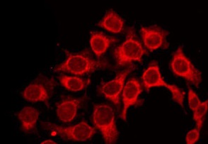 P2RY6 / P2Y6 Antibody - Staining HepG2 cells by IF/ICC. The samples were fixed with PFA and permeabilized in 0.1% Triton X-100, then blocked in 10% serum for 45 min at 25°C. The primary antibody was diluted at 1:200 and incubated with the sample for 1 hour at 37°C. An Alexa Fluor 594 conjugated goat anti-rabbit IgG (H+L) Ab, diluted at 1/600, was used as the secondary antibody.
