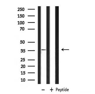 P2RY6 / P2Y6 Antibody - Western blot analysis of extracts of mouse muscle using P2RY6 antibody.