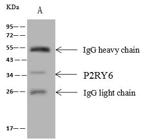P2RY6 / P2Y6 Antibody - P2RY6 was immunoprecipitated using: Lane A: 0.5 mg HepG2 Whole Cell Lysate. 4 uL anti-P2RY6 rabbit polyclonal antibody and 60 ug of Immunomagnetic beads Protein A/G. Primary antibody: Anti-P2RY6 rabbit polyclonal antibody, at 1:100 dilution. Secondary antibody: Goat Anti-Rabbit IgG (H+L)/HRP at 1/10000 dilution. Developed using the ECL technique. Performed under reducing conditions. Predicted band size: 36 kDa. Observed band size: 35 kDa.