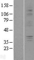 P2RY6 / P2Y6 Protein - Western validation with an anti-DDK antibody * L: Control HEK293 lysate R: Over-expression lysate