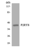 P2RY8 / P2Y8 Antibody - Western blot analysis of the lysates from COLO205 cells using P2RY8 antibody.