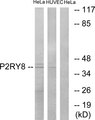 P2RY8 / P2Y8 Antibody - Western blot analysis of lysates from HeLa and HUVEC cells, using P2RY8 Antibody. The lane on the right is blocked with the synthesized peptide.