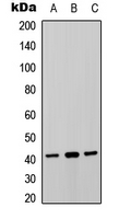 P2RY8 / P2Y8 Antibody - Western blot analysis of P2Y8 expression in HUVEC (A); rat brain (B); rat heart (C) whole cell lysates.