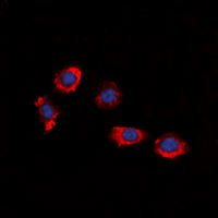 P2RY8 / P2Y8 Antibody - Immunofluorescent analysis of P2Y8 staining in HUVEC cells. Formalin-fixed cells were permeabilized with 0.1% Triton X-100 in TBS for 5-10 minutes and blocked with 3% BSA-PBS for 30 minutes at room temperature. Cells were probed with the primary antibody in 3% BSA-PBS and incubated overnight at 4 deg C in a humidified chamber. Cells were washed with PBST and incubated with a DyLight 594-conjugated secondary antibody (red) in PBS at room temperature in the dark. DAPI was used to stain the cell nuclei (blue).