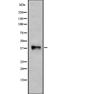 P2Y10 / P2RY10 Antibody - Western blot analysis of P2RY10 using HuvEc whole cells lysates