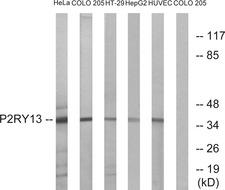 P2Y13 / P2RY13 Antibody - Western blot analysis of lysates from HeLa, COLO, HT-29, HepG2, and HUVEC cells, using P2RY13 Antibody. The lane on the right is blocked with the synthesized peptide.