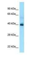 P2Y13 / P2RY13 Antibody - P2Y13 / P2RY13 antibody Western Blot of Fetal Liver.  This image was taken for the unconjugated form of this product. Other forms have not been tested.