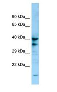 P2Y13 / P2RY13 Antibody - P2Y13 / P2RY13 antibody Western Blot of 721_B.  This image was taken for the unconjugated form of this product. Other forms have not been tested.