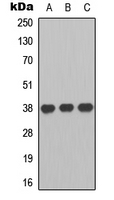 P2Y13 / P2RY13 Antibody - Western blot analysis of GPR86 expression in HeLa (A); Jurkat (B); HUVEC (C) whole cell lysates.