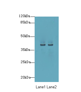 P2Y13 / P2RY13 Antibody - Western blot. All lanes: P2RY13 antibody at 3 ug/ml. Lane 1: HT29 whole cell lysate. Lane 2: Colo320 whole cell lysate. Secondary Goat polyclonal to Rabbit IgG at 1:10000 dilution. Predicted band size: 41 kDa. Observed band size: 41 kDa.
