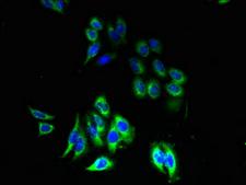 P2Y13 / P2RY13 Antibody - Immunofluorescent analysis of HepG2 cells using P2RY13 Antibody at dilution of 1:100 and Alexa Fluor 488-congugated AffiniPure Goat Anti-Rabbit IgG(H+L)