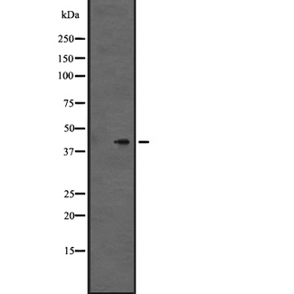 P2Y13 / P2RY13 Antibody - Western blot analysis of GPR86/GPR94 expression in HeLa cells lysate. The lane on the left is treated with the antigen-specific peptide.
