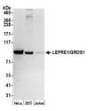 P3H1 / LEPRE1 Antibody - Detection of human LEPRE1/GROS1 by western blot. Samples: Whole cell lysate (50 µg) from HeLa, HEK293T, and Jurkat cells prepared using NETN lysis buffer. Antibody: Affinity purified rabbit anti-LEPRE1/GROS1 antibody used for WB at 0.1 µg/ml. Detection: Chemiluminescence with an exposure time of 3 minutes.