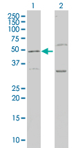 P3H1 / LEPRE1 Antibody - Western blot of LEPRE1 expression in transfected 293T cell line by LEPRE1 monoclonal antibody (M01), clone 3C7.