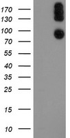 P3H1 / LEPRE1 Antibody - HEK293T cells were transfected with the pCMV6-ENTRY control (Left lane) or pCMV6-ENTRY LEPRE1 (Right lane) cDNA for 48 hrs and lysed. Equivalent amounts of cell lysates (5 ug per lane) were separated by SDS-PAGE and immunoblotted with anti-LEPRE1.