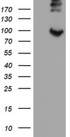 P3H1 / LEPRE1 Antibody - HEK293T cells were transfected with the pCMV6-ENTRY control (Left lane) or pCMV6-ENTRY LEPRE1 (Right lane) cDNA for 48 hrs and lysed. Equivalent amounts of cell lysates (5 ug per lane) were separated by SDS-PAGE and immunoblotted with anti-LEPRE1.