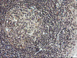 P3H1 / LEPRE1 Antibody - IHC of paraffin-embedded Human tonsil using anti-LEPRE1 mouse monoclonal antibody. (Heat-induced epitope retrieval by 10mM citric buffer, pH6.0, 100C for 10min).