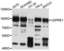 P3H1 / LEPRE1 Antibody - Western blot analysis of extracts of various cell lines, using LEPRE1 antibody at 1:1000 dilution. The secondary antibody used was an HRP Goat Anti-Rabbit IgG (H+L) at 1:10000 dilution. Lysates were loaded 25ug per lane and 3% nonfat dry milk in TBST was used for blocking. An ECL Kit was used for detection and the exposure time was 30s.
